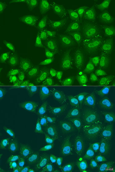 Anti-PLCD4 Antibody (CAB7841)