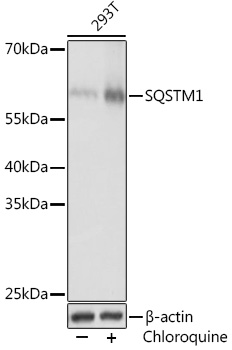 Anti-SQSTM1 Antibody (CAB11246)