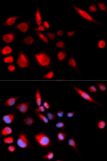 Anti-KIF2C Antibody (CAB5449)