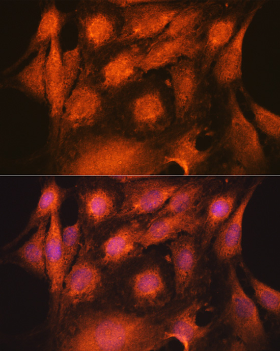 Anti-ASC / TMS1 Antibody (CAB11433)