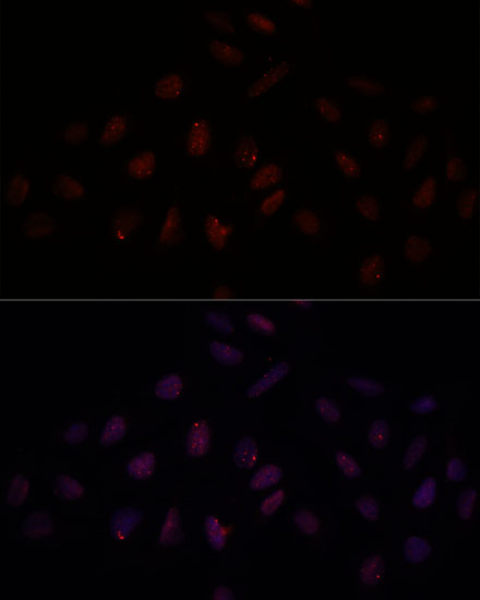 Anti-BRCA1 Antibody (CAB11318)