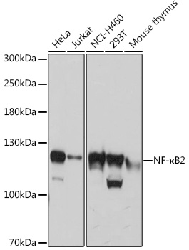 NF-kB2 Rabbit Polyclonal Antibody (CAB3108)