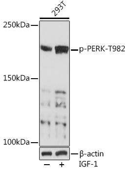 Anti-Phospho-PERK-T982 pAb (CABP0886)