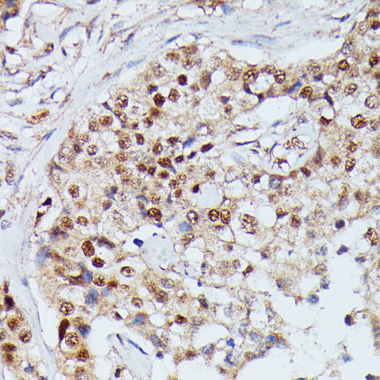 Anti-IGHMBP2 Antibody (CAB16053)