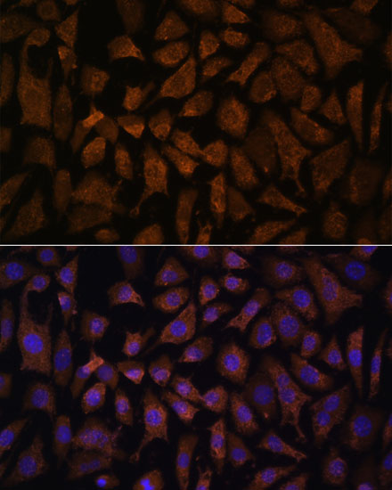 Anti-PPP2R5D Antibody (CAB15707)