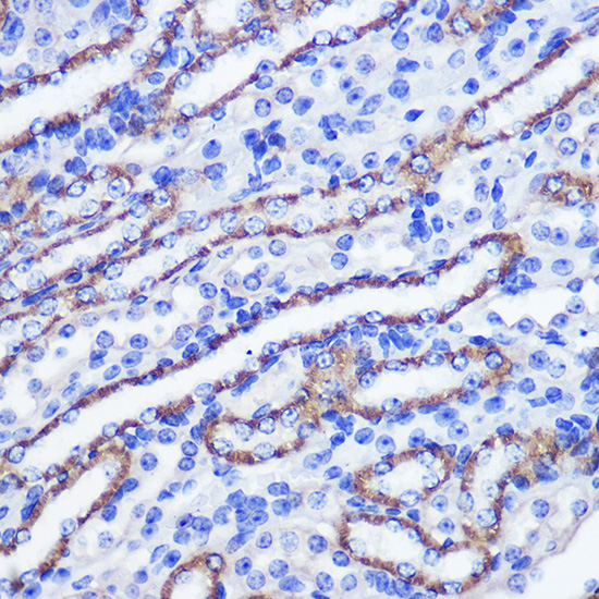 Anti-PHLPP1 Polyclonal Antibody (CAB9542)