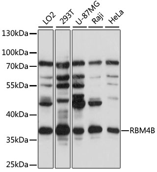 Anti-RBM4B Antibody (CAB14682)