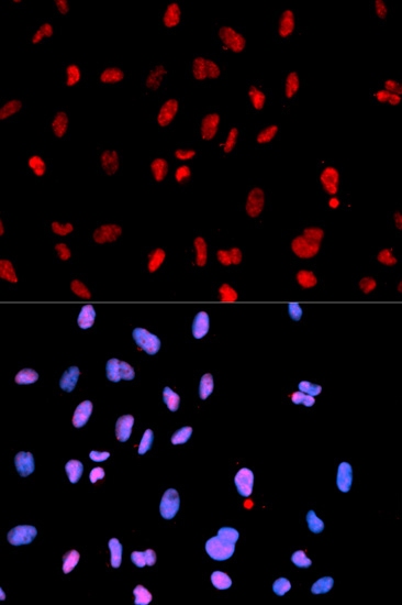 Anti-Phospho-MET-Y1234 Antibody (CABP0078)