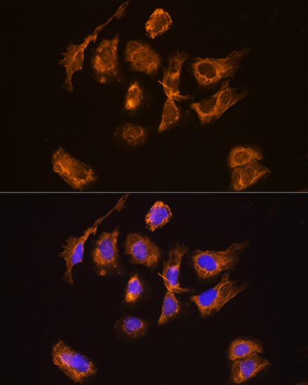 Anti-TRH Antibody (CAB14472)