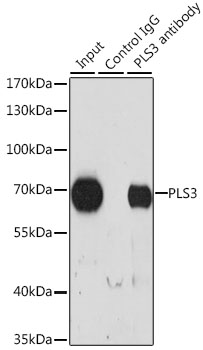 Anti-PLS3 Antibody (CAB3627)