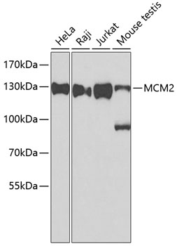 Anti-MCM2 Antibody (CAB0502)