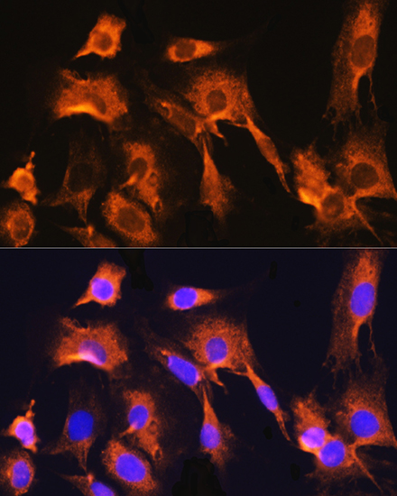 Anti-ADAM9 Antibody (CAB5388)