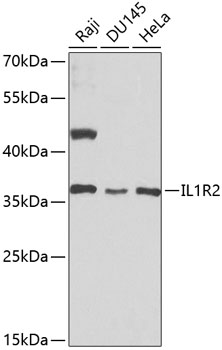 Anti-IL-1R2 Antibody (CAB1899)