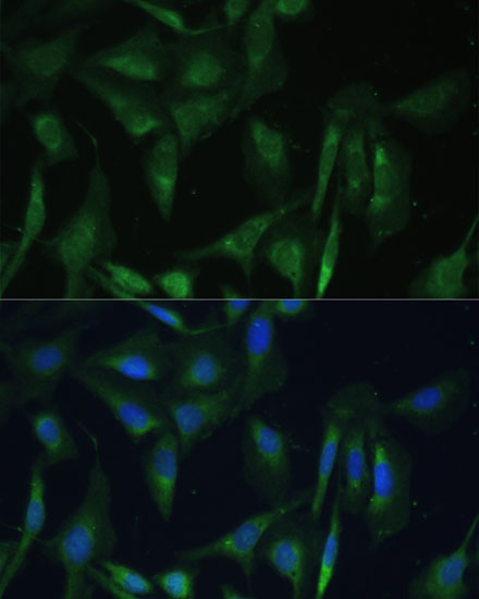 Anti-CAMLG Antibody (CAB13720)