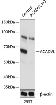 Anti-ACADVL Antibody [KO Validated] (CAB19973)