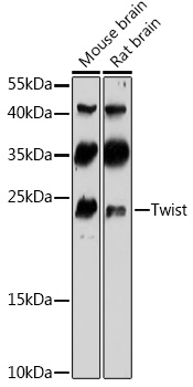 Anti-Twist Antibody (CAB3237)