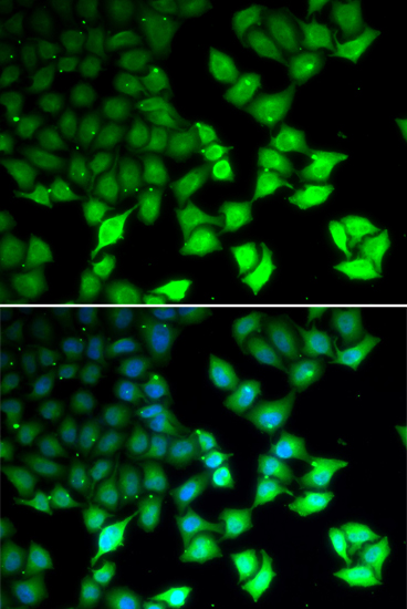 Anti-KDM4B Antibody (CAB5824)