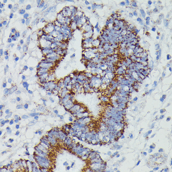 Anti-NDUFAB1 Antibody (CAB14657)