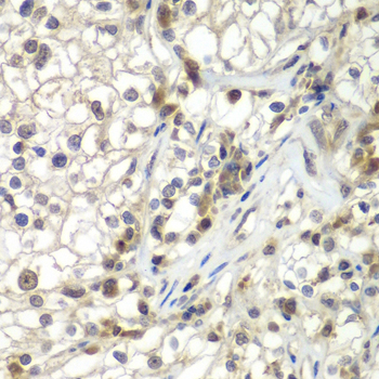 Anti-ASPSCR1 Antibody (CAB7481)