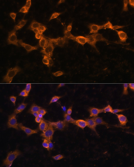 Anti-PDGFR beta Antibody (CAB2180)