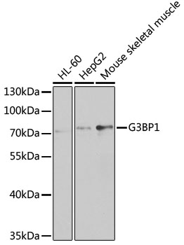 Anti-G3BP1 Antibody (CAB5342)