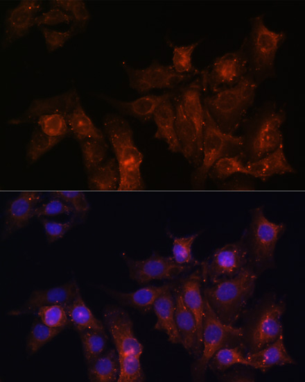 Anti-DMD Antibody (CAB1411)