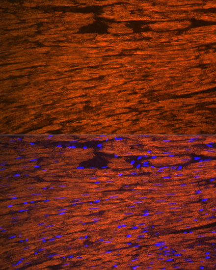 Anti-MYL2 Antibody (CAB14188)