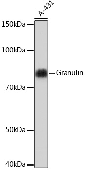 Anti-Granulin Antibody (CAB5124)