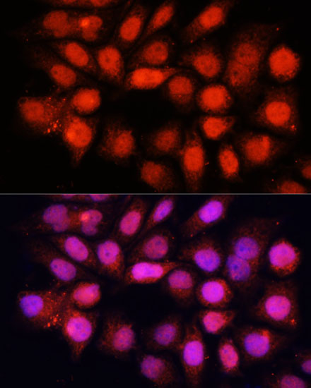 Anti-DDB1 Antibody (CAB2896)