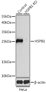 Anti-HSPB1 Antibody [KO Validated] (CAB16332)