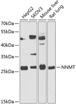 Anti-NNMT Antibody (CAB14030)