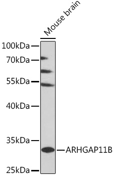 Anti-ARHGAP11B Antibody (CAB16587)