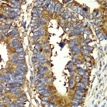 Anti-QARS Antibody (CAB6960)