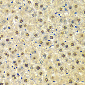 Anti-SPHK1 Antibody (CAB0139)