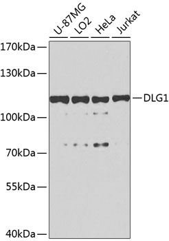 Anti-DLG1 Polyclonal Antibody (CAB8542)