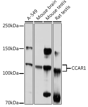 Anti-CCAR1 Antibody (CAB13595)