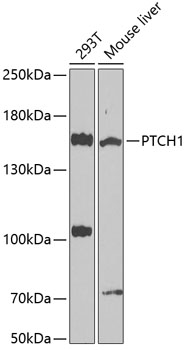 Anti-PTCH1 Antibody (CAB0826)