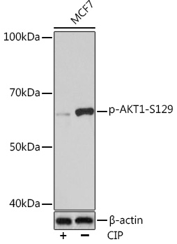 Anti-Phospho-AKT1-S129 Antibody (CABP0981)