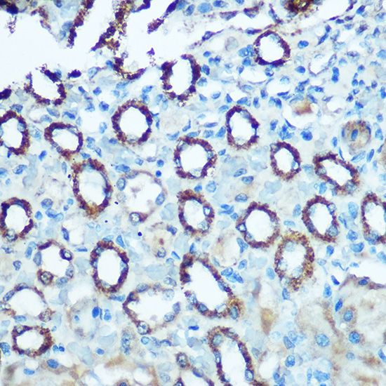 Anti-NDUFS4 Antibody (CAB6390)