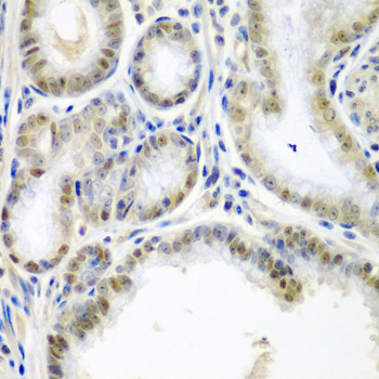 Anti-SSX2 Antibody (CAB6989)