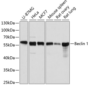 Anti-Beclin 1 Antibody [KO Validated] (CAB7353)