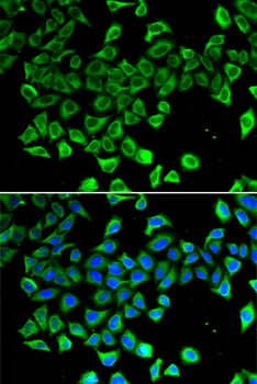 Anti-LCN2 Antibody (CAB11130)