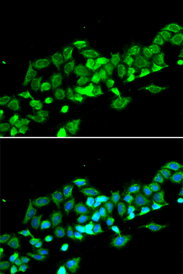 Anti-RASSF1 Antibody (CAB12567)