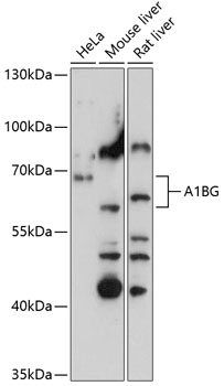 Anti-A1BG Antibody (CAB15015)