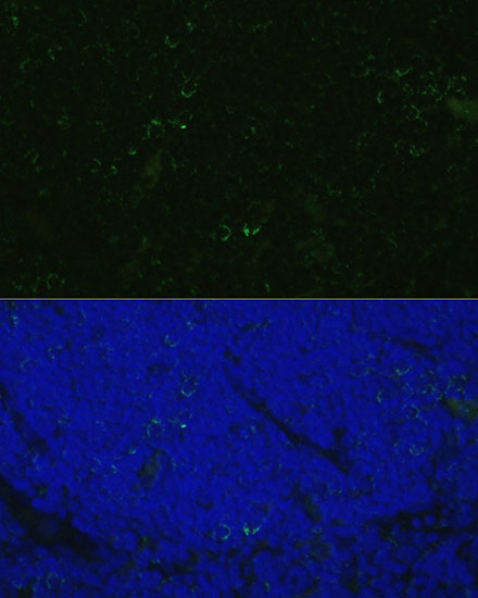 Anti-CD4 Antibody (CAB0362)