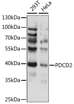 Anti-PDCD2 Antibody (CAB15299)