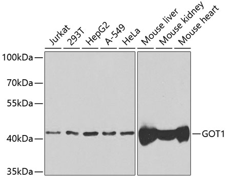 Anti-GOT1 Antibody (CAB5822)