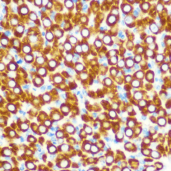 Anti-SCO2 Antibody (CAB7051)