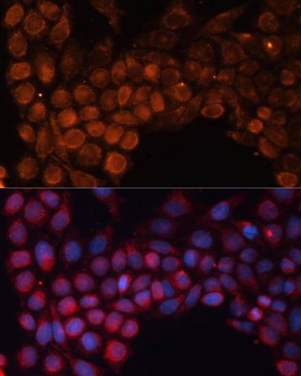 Anti-SLC25A24 Antibody (CAB12138)