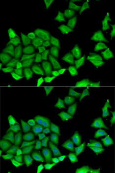 Anti-RPS7 Antibody (CAB6731)